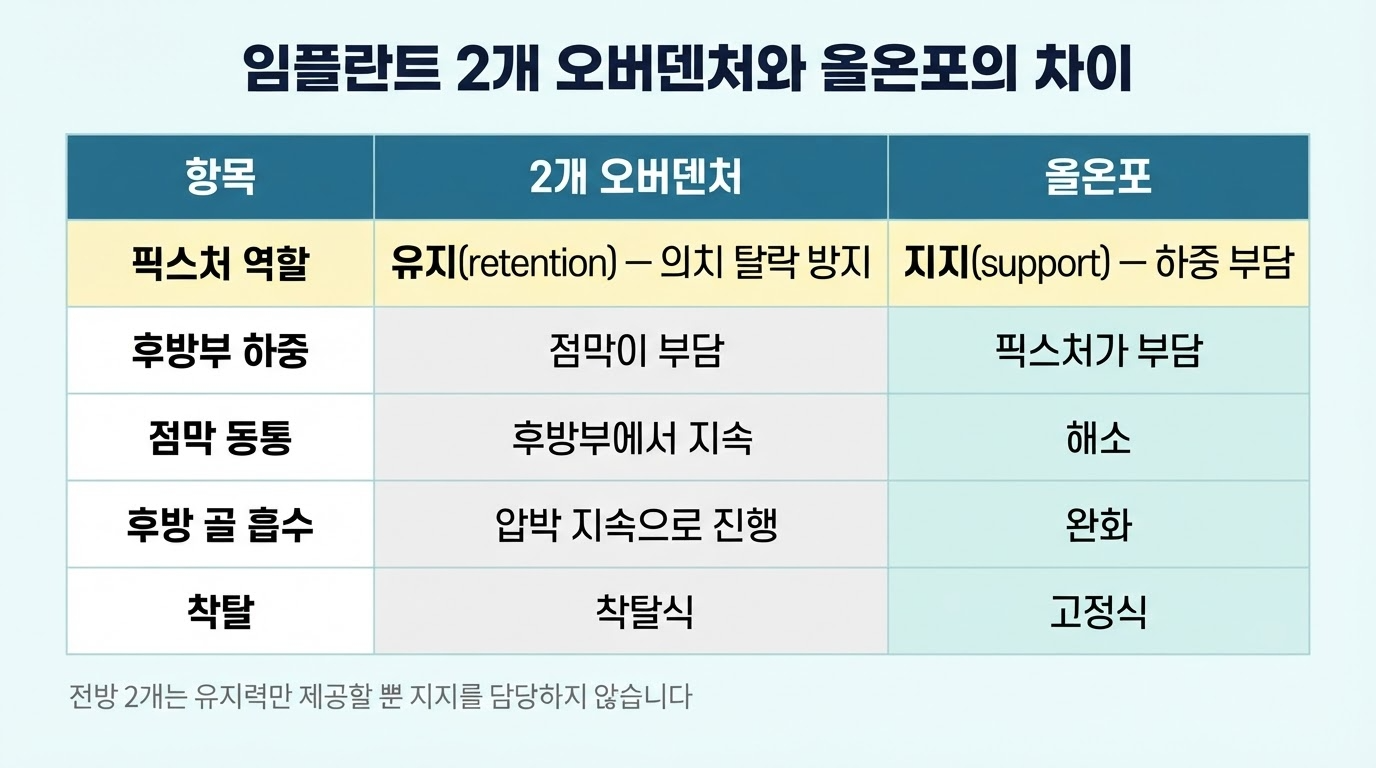 올온포(All-on-4)란 — 네 개로 전악을 수복하는 원리