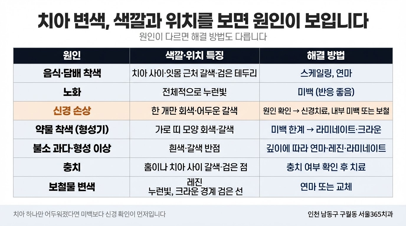 치아 변색 원인과 해결 — 색깔로 구별하는 법
